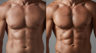 Body Contouring Training: Most Lucrative Procedures to Learn in 2025 Picture