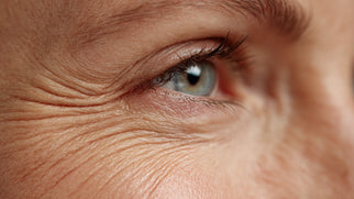 Under Eye Crepey Skin Treatment: Restore Smooth, Firm Texture Picture