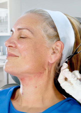 Dominio en Hilos de Tracción: Curso Virtual Avanzado de Lifting Facial No Quirúrgico Workshop Picture