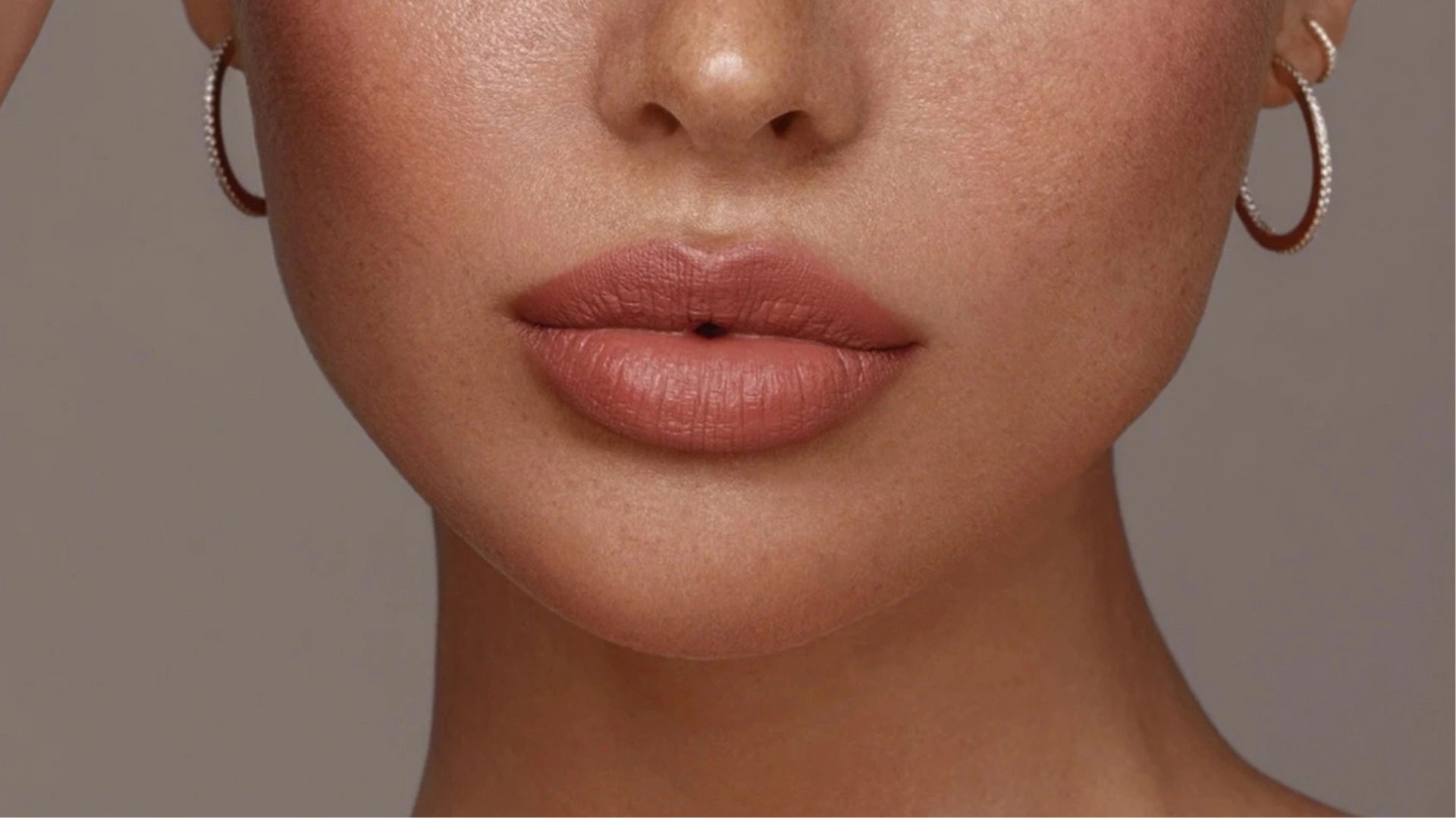 Erase Lip Lines, Elevate Results: Non-Injectable Perioral Rejuvenation with Plexr® Picture