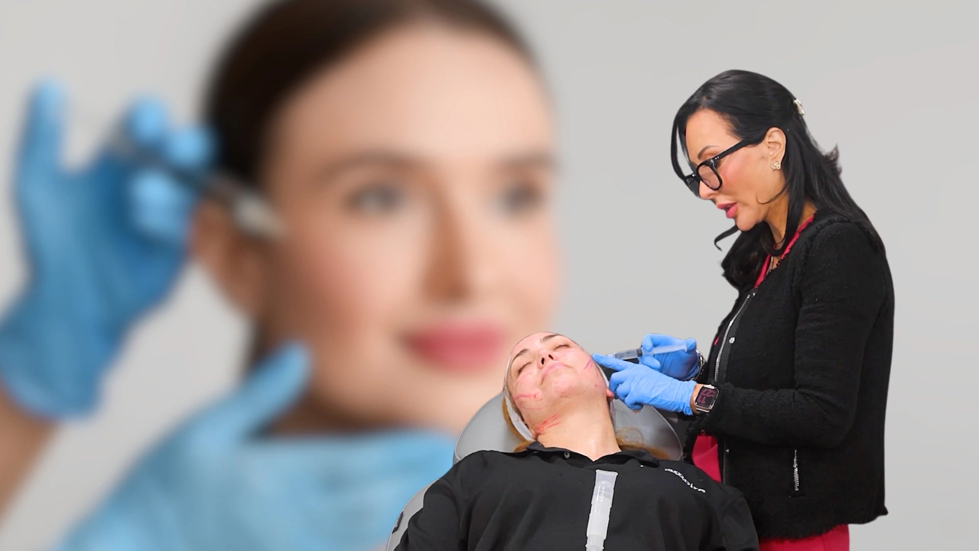Treating the Full Face Using Fillers and PDO Threads Picture