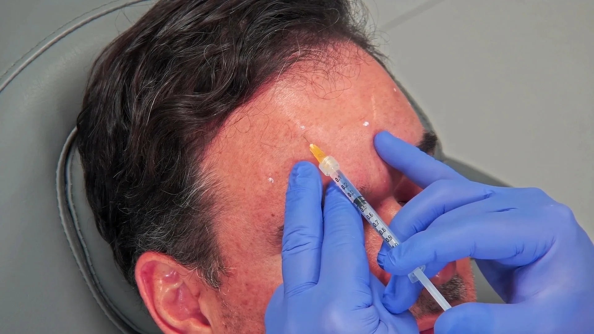 Frontalis 1 - Empire On-Demand